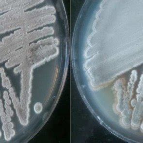 Morphological Appearance Of MN38 Isolates A And MN39 B On Starch