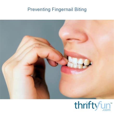 Preventing Fingernail Biting | ThriftyFun