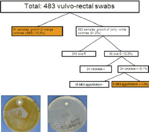 Results of GBS detection. | Download Scientific Diagram