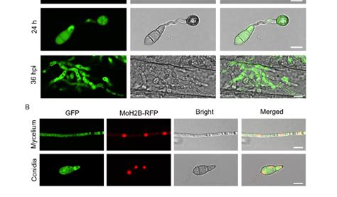 Subcellular Localization Of Monap1 At Different Developmental Stages Of