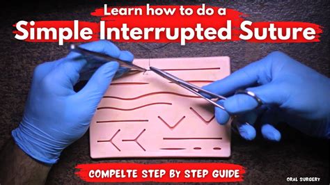 How To To Do A Simple Interrupted Suture Complete Step By Step Guide