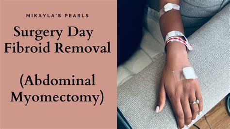 Surgery Day Fibroid Removal Abdominal Myomectomy Procedure TTC