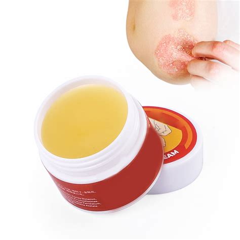 Eczema Cream Psoriasis Dermatitis Pruritus Eczematoid Ointment Chinese