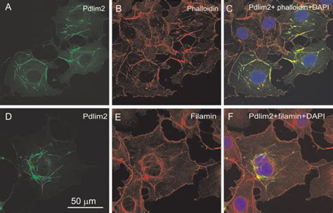 Co Localization Of Pdlim With Actin Stress Fibers And Filamin