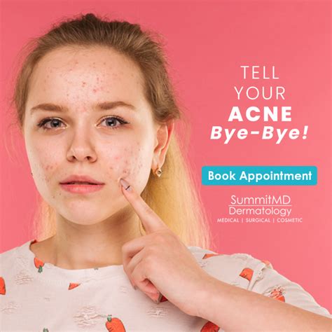 Adult Acne Summitmd Dermatology