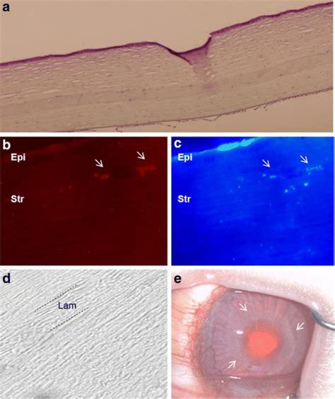 Reconstruction Of Corneal Stroma A Hematoxylin Eosin Staining Of A