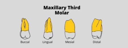 Maxillary Third Molar Morphology Of Tooth Dental Education Hub