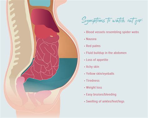 Abdomen Ascites Liver Disease Hot Sex Picture