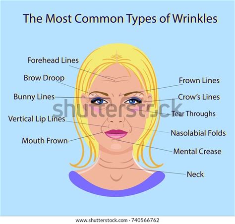 Common Types Facial Wrinkles Cosmetic Surgery Stock Vector (Royalty Free) 740566762 | Shutterstock