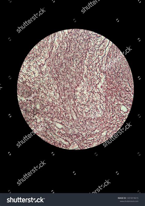 Reticular Tissue By Light Microscope Stock Photo 1201819615 | Shutterstock