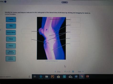 Solved Identity The Bones And Features Indicated In This Chegg