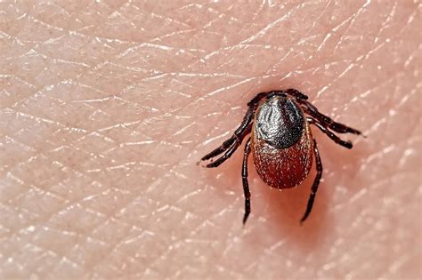 18 Fun Facts About Lyme Disease Facts Net