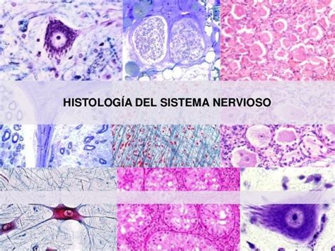 Tejido Nervioso Histologia | Porn Sex Picture