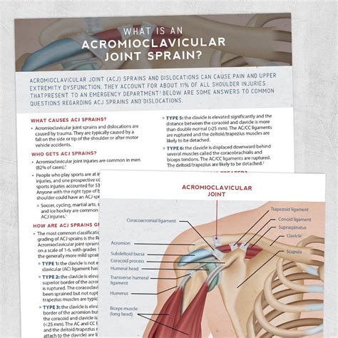 Acromioclavicular Joint Sprain