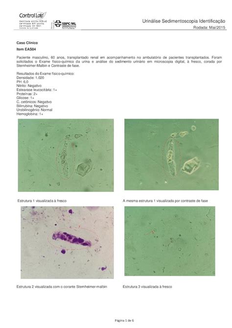 Pdf Urin Lise Sedimentoscopia Identifica O O Pdf