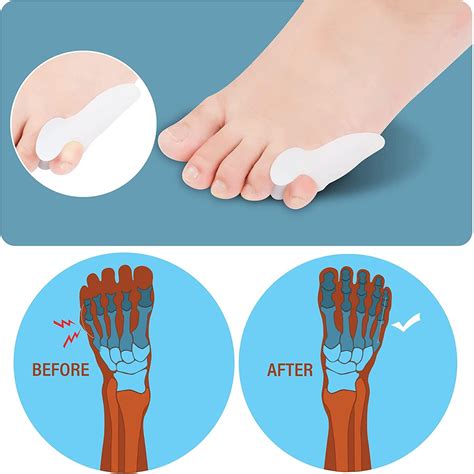 Pinky Toe Gel Bunion Protector & Separator for Pain Relief - DYKOOK ...