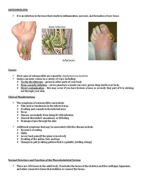 Osteomyelitis | Bone | Skeleton