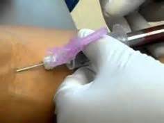 Phlebotomy Ideas Phlebotomy Nurse Medical Laboratory