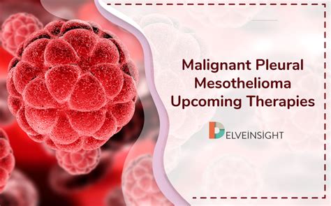 Malignant Pleural Mesothelioma Upcoming Therapies