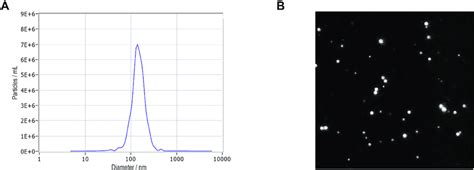 Characterization of isolated exosomes. (A) Nanoparticle tracking ... 