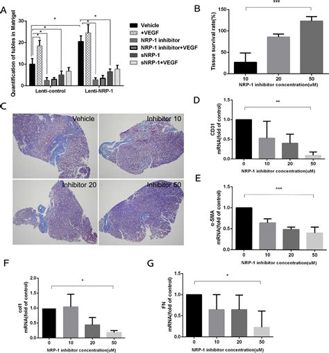 Neuropilin 1 Aggravates Liver Cirrhosis By Promoting Angiogenesis Via