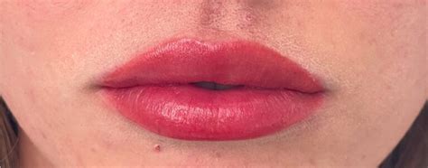 Portfolio Lip Blush Before And After Sian Dellar