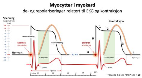 Index Of Elaring Fag Hjertesykdommer Spl Ekg Del Images