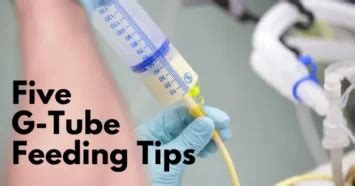 Five G-Tube Feeding Tips - Personally Delivered Blog