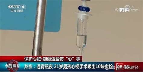 熬夜党注意！21岁男子长期熬夜吸出10块血栓，这些信号要警惕！ 视频截图由于不健康的生活习惯，心梗患者的年龄呈年轻化趋势。21岁的小蒲因突发心