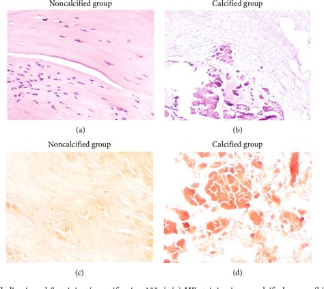 Figure From The Effect Of Osteoprotectin Opg Receptor Activator Of