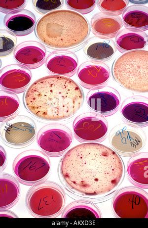 Coliform Bacteria Growing On Petri Dishes Coliform Bacteria Growing On