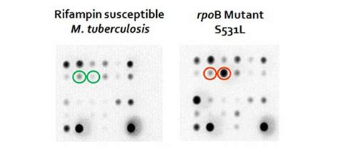 Truarray Mdr Tb Assay Akonni Biosystems