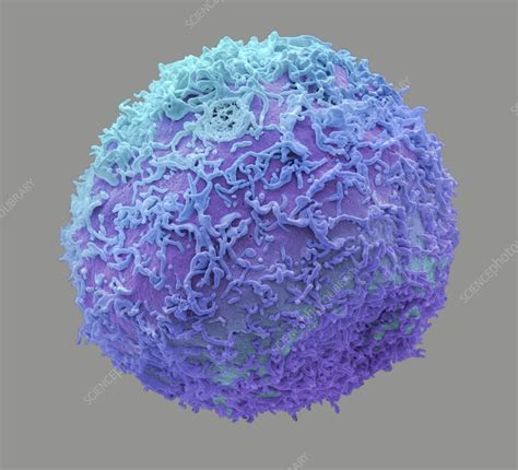 Prostate Cancer Cell SEM Stock Image C023 1815 Science Photo Library