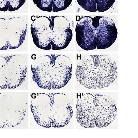 Delayed Ol Differentiation And Maturation Following Conditional