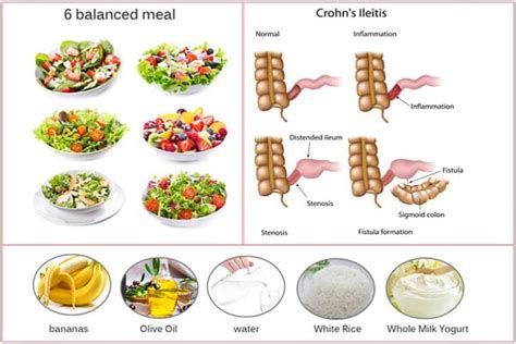 Nutrition for Crohn’s disease – Healthy Food Near Me