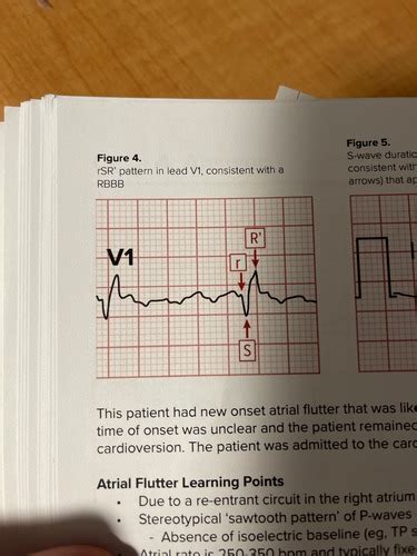 Cardiac Flashcards Quizlet