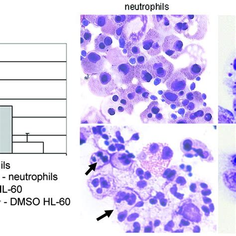 Pdf Defective Phagocytosis In Anaplasma Phagocytophilum Infected