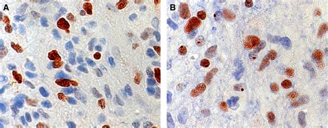 H3k27me3 Immunostaining For Sex Determination In The Context Of