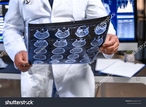 Senior Neurologist Mri Scan Human Head Stock Photo 2004472187 ...