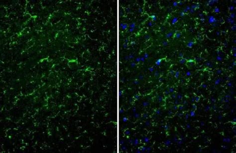 TMEM119 Antibody HL2415 Azide And BSA Free NBP3 25724 Novus