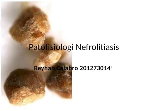 PPTX Patofisiologi Nefrolitiasis DOKUMEN TIPS