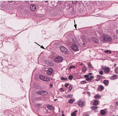 Pcom M1t1 Histology Of Epithelial Tissue Flashcards Quizlet