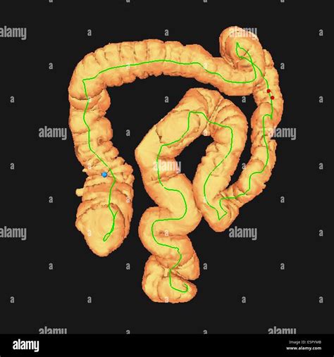 D Computed Tomography Ct Scan Of The Colon Stock Photo Alamy