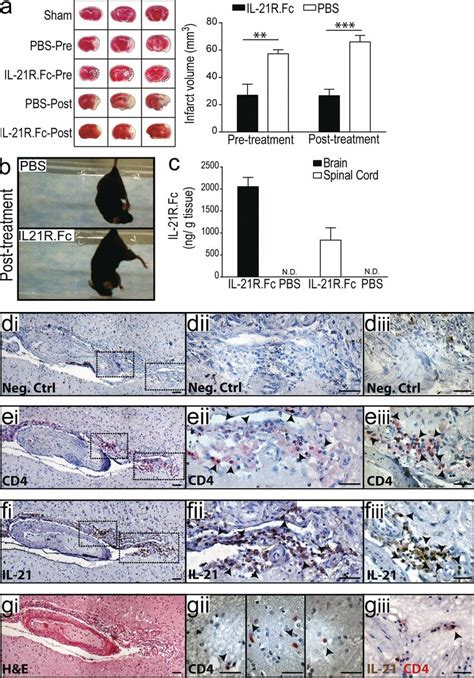 Blockade Of Il Signaling Before Or After Tmcao Reduces Infarct Size