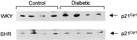 Western Blots Of Lysates Of Isolated Glomeruli From Control SHR And WKY