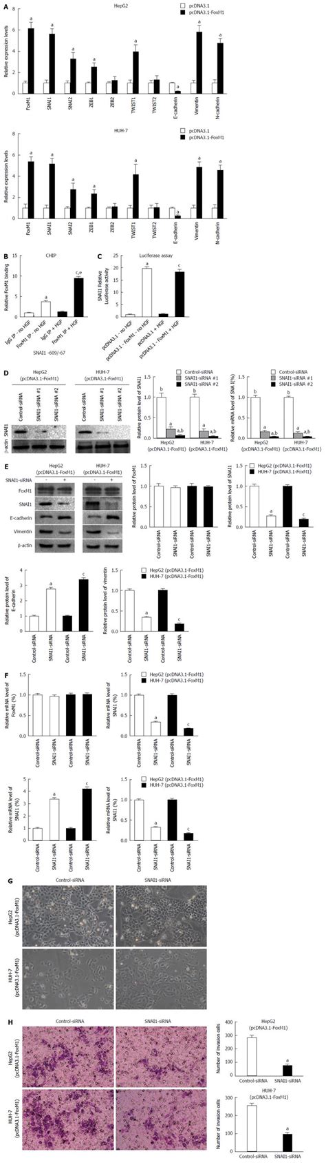 Foxm1 Overexpression Promotes Epithelial Mesenchymal Transition And