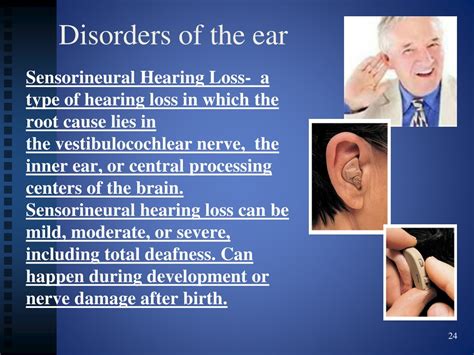 Ppt Ears Powerpoint Presentation Free Download Id 9125213