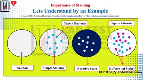 Staining Types Purpose Procedure And Lab Test Information 55 Off