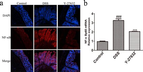 Y 27632 Inhibited Nf κb Activation In Mice Subjected To Dss Induced