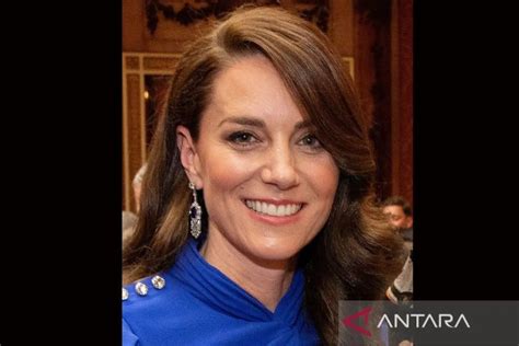 Kate Middleton Tampil Untuk Kali Pertama Usai Operasi Malang Posco Media